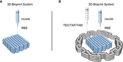 Exploring the function of stromal cells in cholangiocarcinoma by three-dimensional bioprinting immune microenvironment model